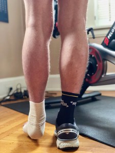 The state of my muscle loss on June 9. 2019.