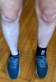 Preparing for a run with my awful ankle brace.